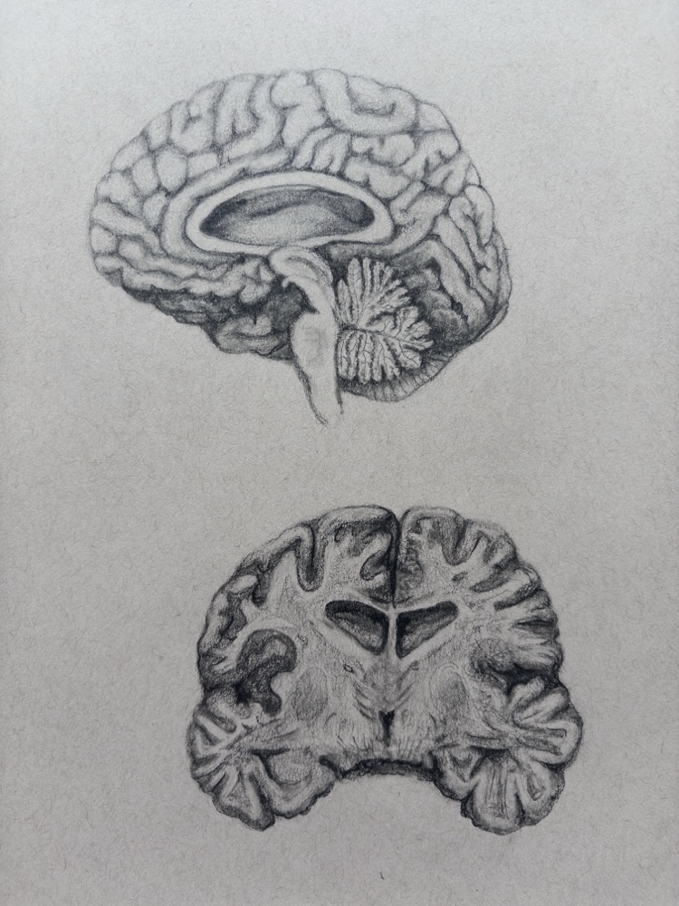 Sagittal and coronal brain studies